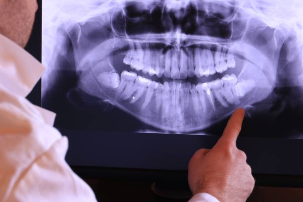 Best Broken or Cracked Tooth Emergency Dentist in Yellville, AR
