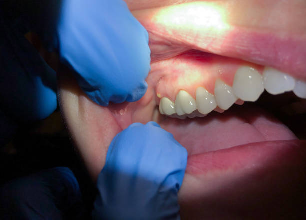 Best Weekend Emergency Dentist in Yellville, AR
